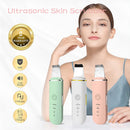 Purificador de pele ultra-sônico para limpeza facial removedor de cravos e impurezas (Um novo ciclo para a sua pele)