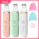 Purificador de pele ultra-sônico para limpeza facial removedor de cravos e impurezas (Um novo ciclo para a sua pele)