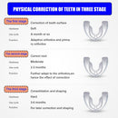 Acessório alinhador de dentes(Aparelho ortodôntico,tenha o sorriso dos sonhos)