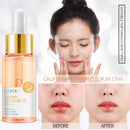 Ácido Hialurônico,Vitamina C (Remoção de Acne Líquido Anti-rugas Anti-envelhecimento)